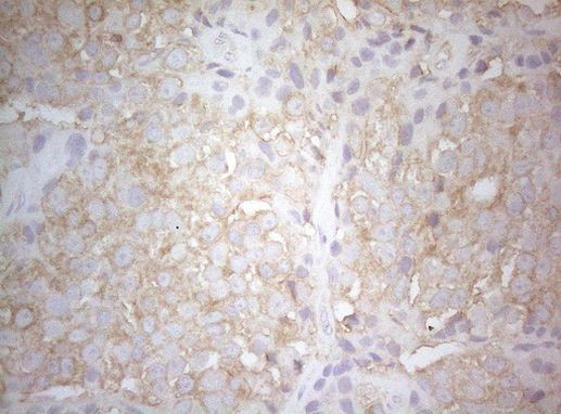 PTK9 Antibody in Immunohistochemistry (Paraffin) (IHC (P))