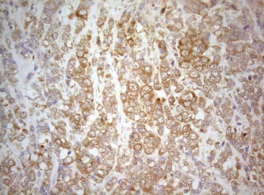 PTK9 Antibody in Immunohistochemistry (Paraffin) (IHC (P))