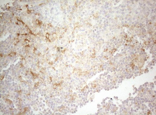 PTK9 Antibody in Immunohistochemistry (Paraffin) (IHC (P))