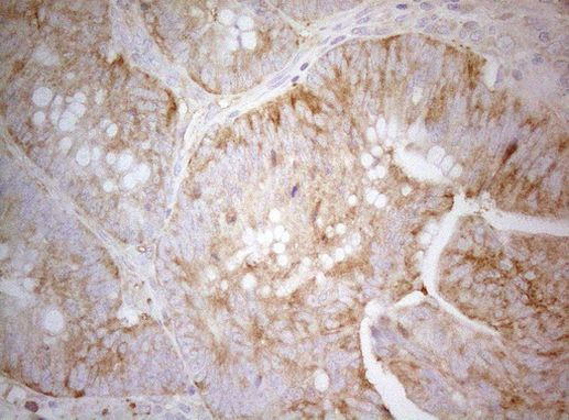 PTK9 Antibody in Immunohistochemistry (Paraffin) (IHC (P))