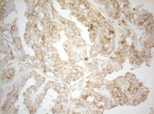 PTK9 Antibody in Immunohistochemistry (Paraffin) (IHC (P))