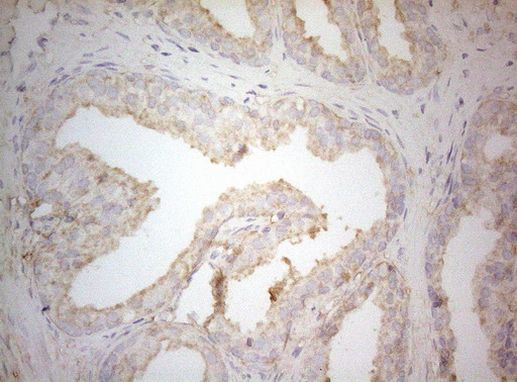 PTK9 Antibody in Immunohistochemistry (Paraffin) (IHC (P))