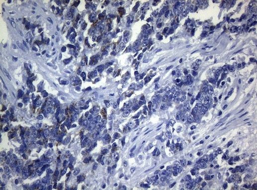 SEC14L1 Antibody in Immunohistochemistry (Paraffin) (IHC (P))