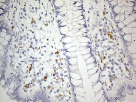 ZNF217 Antibody in Immunohistochemistry (Paraffin) (IHC (P))