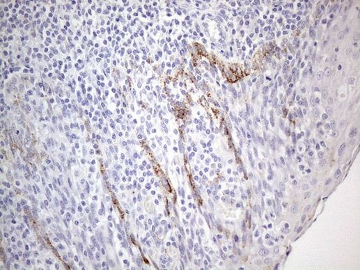 ZNF217 Antibody in Immunohistochemistry (Paraffin) (IHC (P))