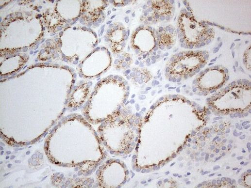 ZNF217 Antibody in Immunohistochemistry (Paraffin) (IHC (P))