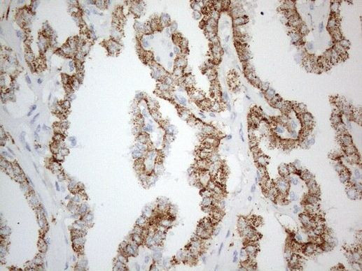 ZNF217 Antibody in Immunohistochemistry (Paraffin) (IHC (P))