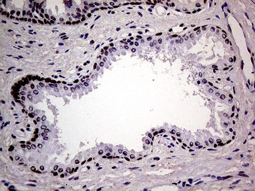 MAGEB4 Antibody in Immunohistochemistry (Paraffin) (IHC (P))