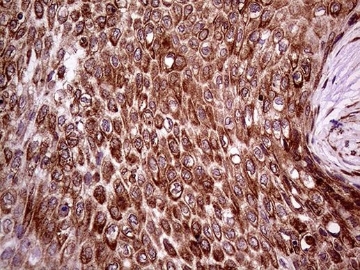 ERLIN1 Antibody in Immunohistochemistry (Paraffin) (IHC (P))