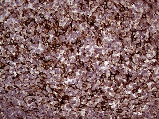 ERLIN1 Antibody in Immunohistochemistry (Paraffin) (IHC (P))