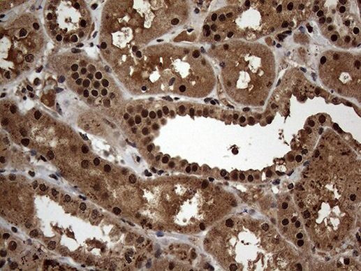 SSU72 Antibody in Immunohistochemistry (Paraffin) (IHC (P))