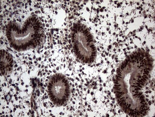 SSU72 Antibody in Immunohistochemistry (Paraffin) (IHC (P))