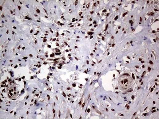 SSU72 Antibody in Immunohistochemistry (Paraffin) (IHC (P))