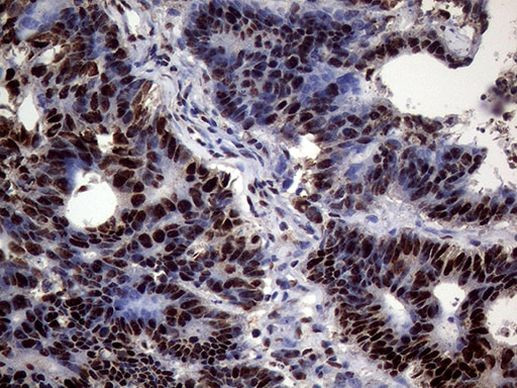 SSU72 Antibody in Immunohistochemistry (Paraffin) (IHC (P))