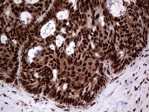 SSU72 Antibody in Immunohistochemistry (Paraffin) (IHC (P))