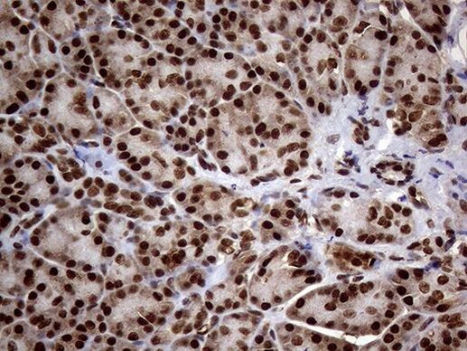 SSU72 Antibody in Immunohistochemistry (Paraffin) (IHC (P))