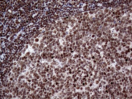 SSU72 Antibody in Immunohistochemistry (Paraffin) (IHC (P))