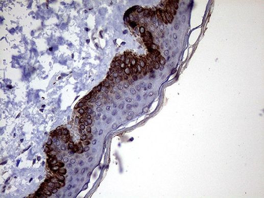 P4HA3 Antibody in Immunohistochemistry (Paraffin) (IHC (P))