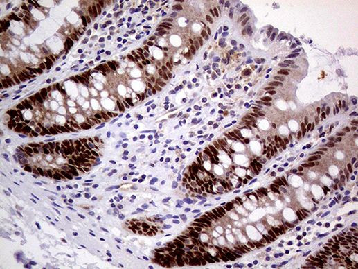 MAGEB4 Antibody in Immunohistochemistry (Paraffin) (IHC (P))