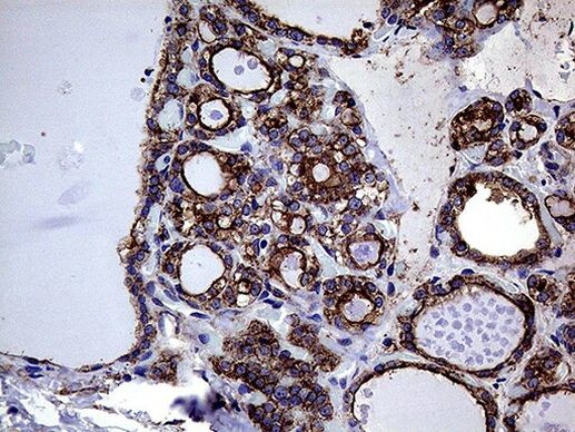 GNAS Antibody in Immunohistochemistry (Paraffin) (IHC (P))