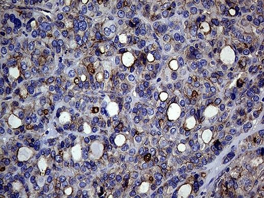 GNAS Antibody in Immunohistochemistry (Paraffin) (IHC (P))