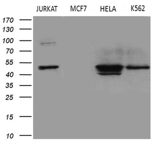 GNAS Antibody in Western Blot (WB)