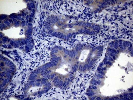 CEP63 Antibody in Immunohistochemistry (Paraffin) (IHC (P))