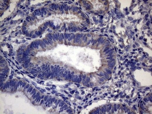 CEP63 Antibody in Immunohistochemistry (Paraffin) (IHC (P))