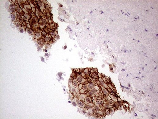 GNAS Antibody in Immunohistochemistry (Paraffin) (IHC (P))