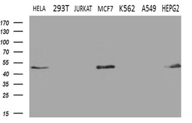 GNAS Antibody in Western Blot (WB)