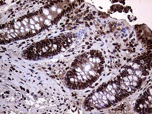 TRMT5 Antibody in Immunohistochemistry (Paraffin) (IHC (P))