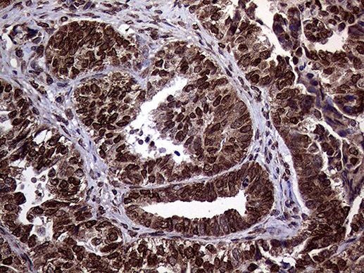 TRMT5 Antibody in Immunohistochemistry (Paraffin) (IHC (P))