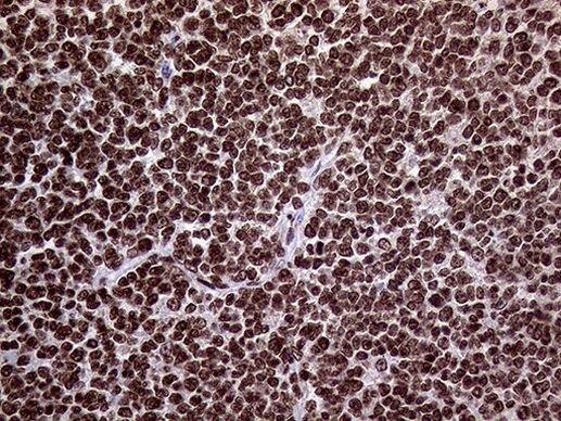 TRMT5 Antibody in Immunohistochemistry (Paraffin) (IHC (P))