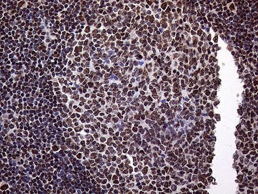 TRMT5 Antibody in Immunohistochemistry (Paraffin) (IHC (P))