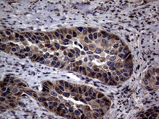 PITPNB Antibody in Immunohistochemistry (Paraffin) (IHC (P))