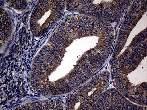 PITPNB Antibody in Immunohistochemistry (Paraffin) (IHC (P))