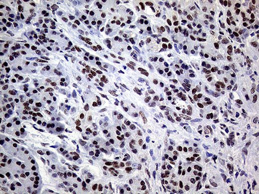 XPB Antibody in Immunohistochemistry (Paraffin) (IHC (P))