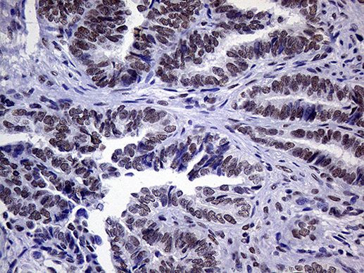 XPB Antibody in Immunohistochemistry (Paraffin) (IHC (P))