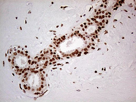 FTO Antibody in Immunohistochemistry (Paraffin) (IHC (P))