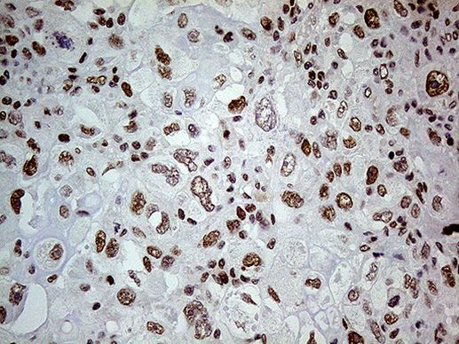 FTO Antibody in Immunohistochemistry (Paraffin) (IHC (P))