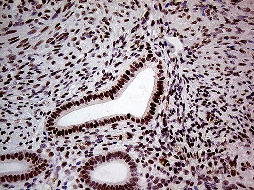 FTO Antibody in Immunohistochemistry (Paraffin) (IHC (P))