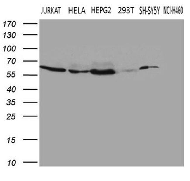 FTO Antibody in Western Blot (WB)