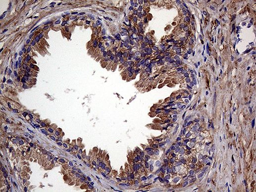 RAB23 Antibody in Immunohistochemistry (Paraffin) (IHC (P))