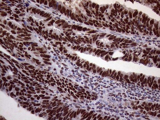 XRN2 Antibody in Immunohistochemistry (Paraffin) (IHC (P))