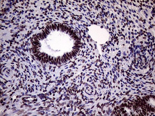 XRN2 Antibody in Immunohistochemistry (Paraffin) (IHC (P))