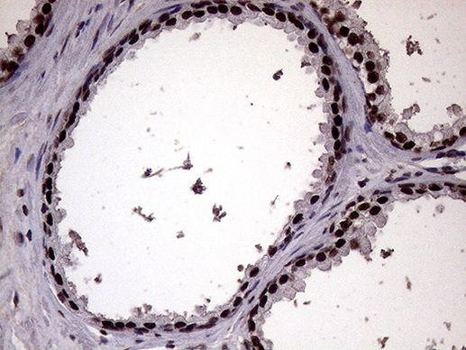 XRN2 Antibody in Immunohistochemistry (Paraffin) (IHC (P))