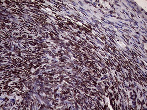 XRN2 Antibody in Immunohistochemistry (Paraffin) (IHC (P))