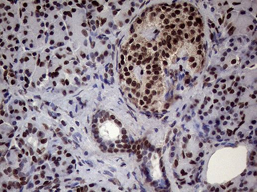 XRN2 Antibody in Immunohistochemistry (Paraffin) (IHC (P))