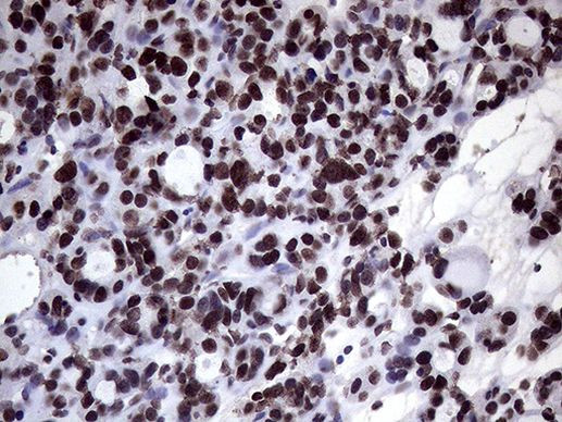 XRN2 Antibody in Immunohistochemistry (Paraffin) (IHC (P))