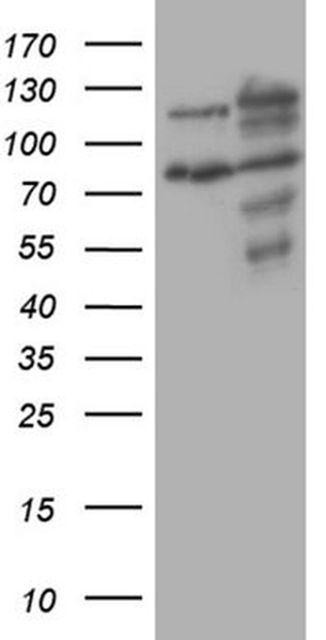 XRN2 Antibody in Western Blot (WB)